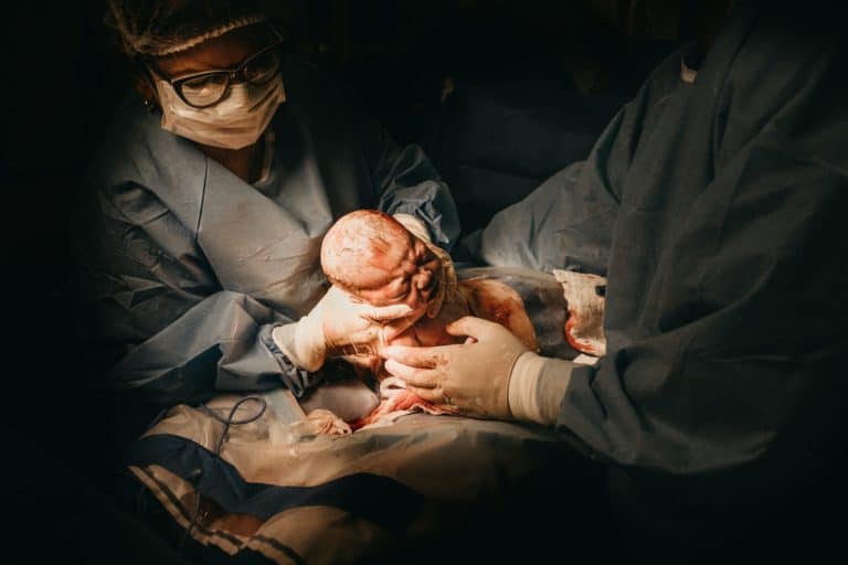 רופאים מיילדים תינוק